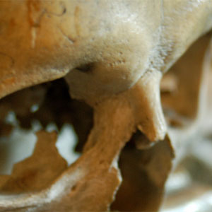 skullCREDtoddHuffman